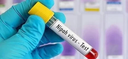 Nipah Virus Bangladesh World Health Organization Confirm One Person Dead Www.thehindi.in